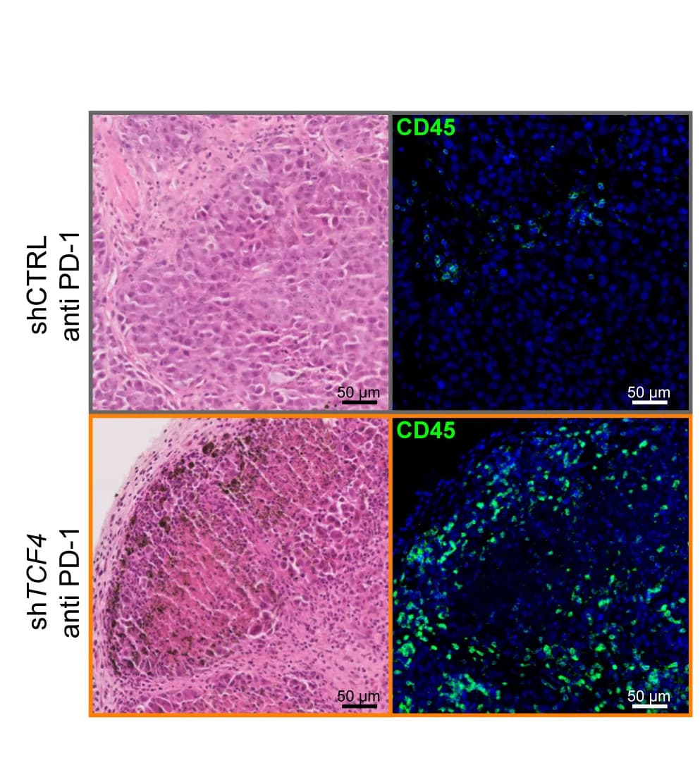 Open access visualization of Microscopy, H&E Staining, Tumor Sections, Anti-PD-1, Immunofluorescence