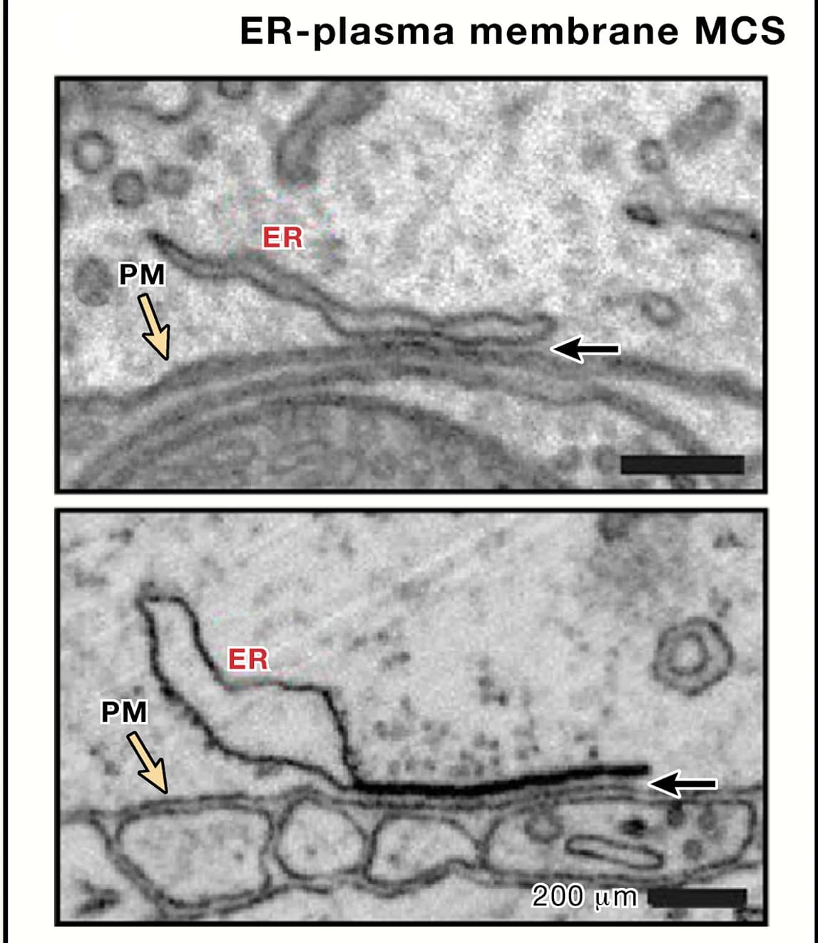 Open access visualization of Microscopy, ER-Plasma Membrane MCS, Neuron, Focused Ion Beam Milling, Scanning Electron Microscopy