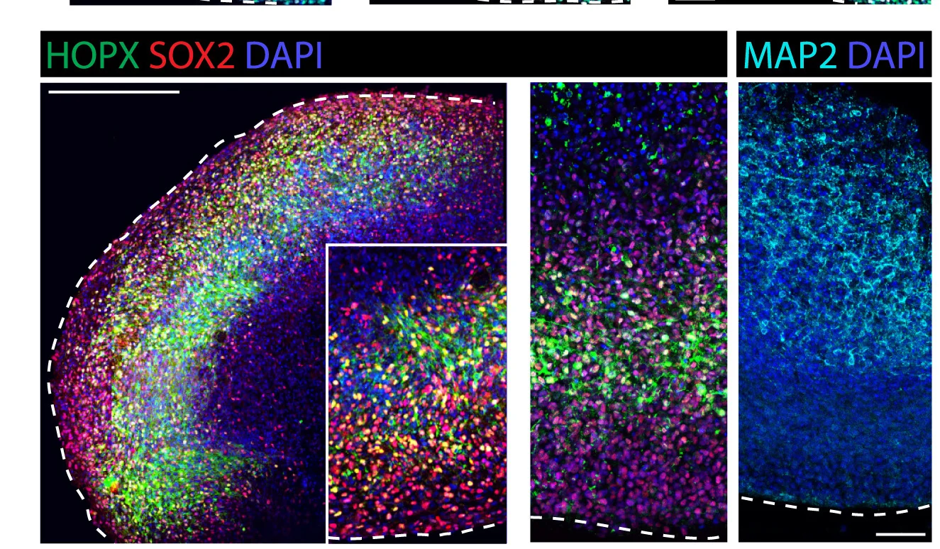Open access visualization of Microscopy, Immunofluorescence, Markers, Cellular Composition, FeBO