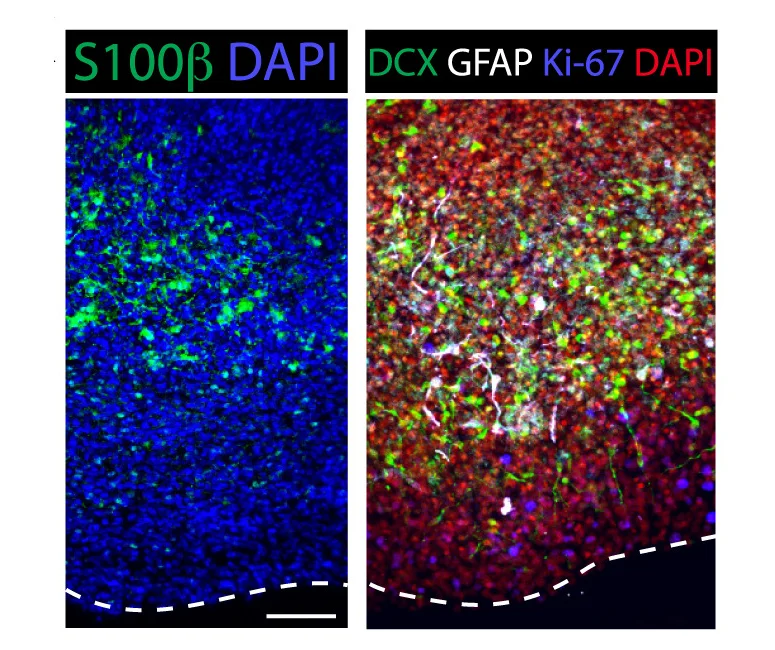 Open access visualization of Microscopy, Immunofluorescence, Markers, Astrocytes, FeBO