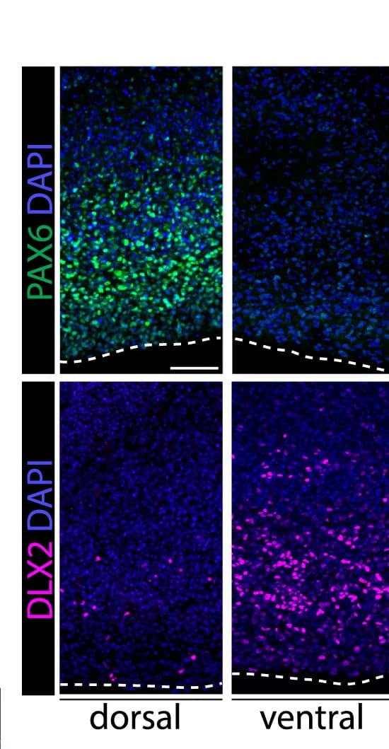 Open access visualization of Microscopy, Immunofluorescence Images, PAX6, Dorsal Forebrain Marker, DLX2