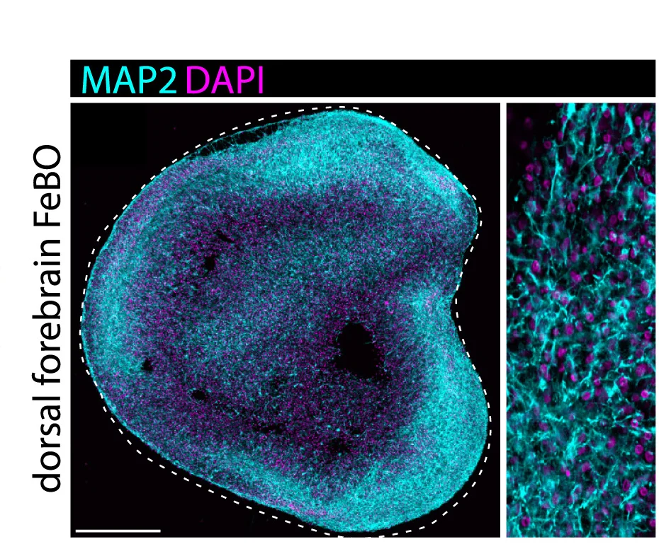Open access visualization of Microscopy, Immunofluorescence Images, MAP2, Dorsal Forebrain FeBOs, Matured FeBOs
