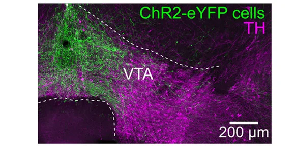 Open access visualization of Microscopy, Glutamatergic Neurons, VTA, Coronal Section, Tyrosine Hydroxylase