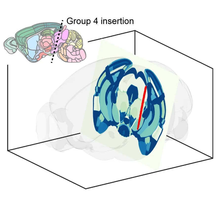 Open access visualization of 3D Plot, Electrode Insertion, Midbrain Nuclei, Electrode Track