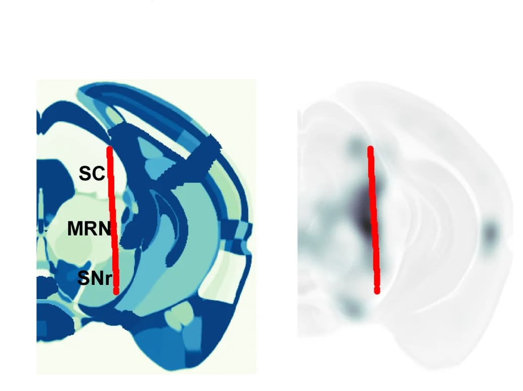 Open access visualization of Microscopy, Allen Reference Atlas, ALM Projection, Electrode Track, SC