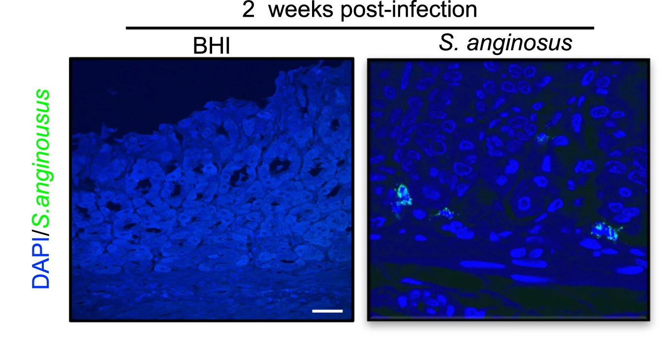 Open access visualization of Microscopy, Fluorescence In Situ Hybridization, Gastric Tissue, Streptococcus Anginosus, Brain Heart Infusion