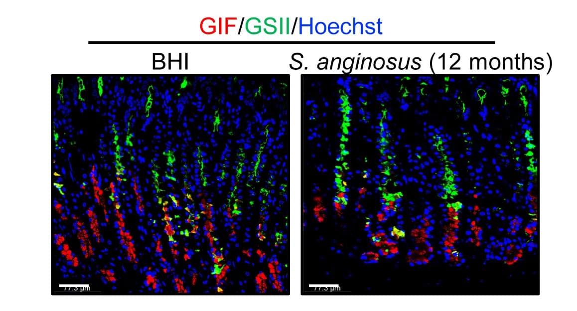 Open access visualization of Microscopy, Chief Cell Marker, Gastric Intrinsic Factor, GIF, Mucus Neck Cell Marker