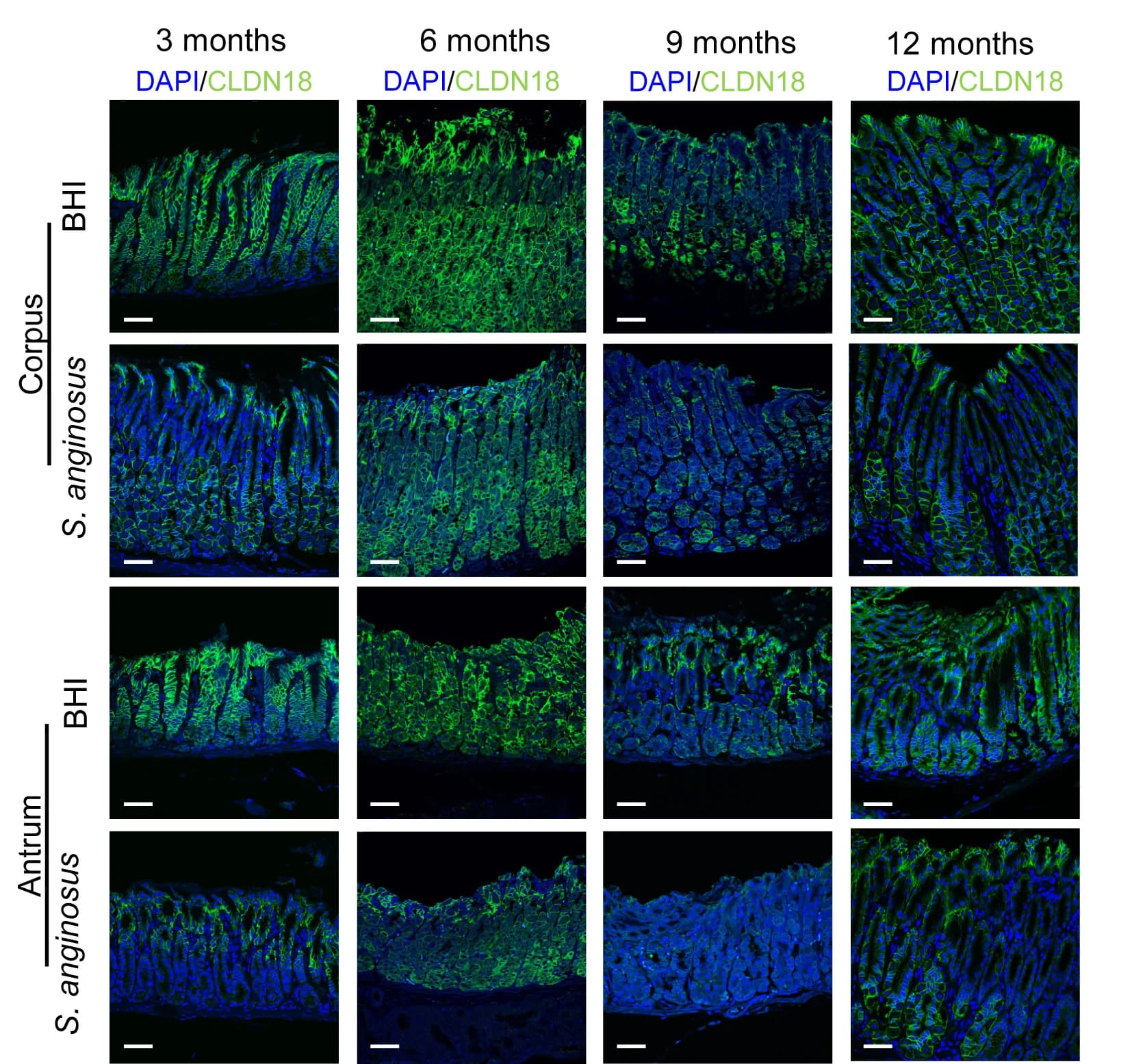 Open access visualization of Microscopy, Immunofluorescence, CLDN18 Staining, Gastric Mucosa