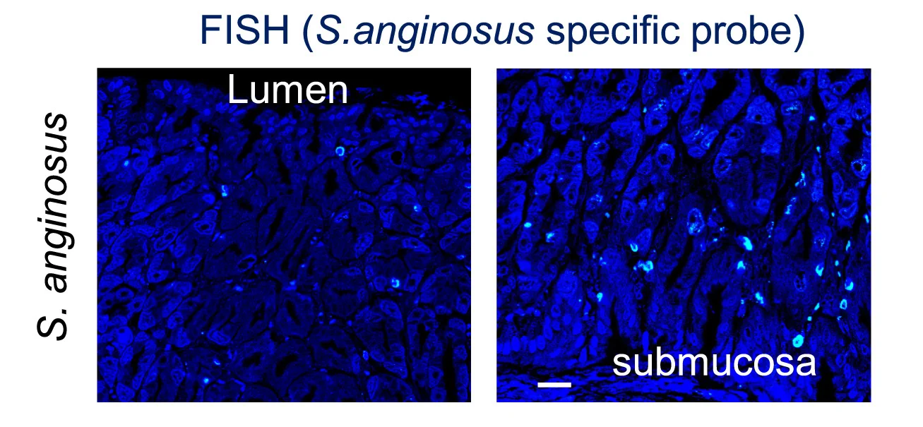 Open access visualization of Microscopy, S. Anginosus, Colonization, Bacteria Loads, FISH