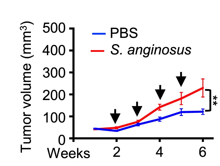 Open access visualization of Line Plot, Error Bars, Tumor Growth Curve, S. Anginosus, PBS
