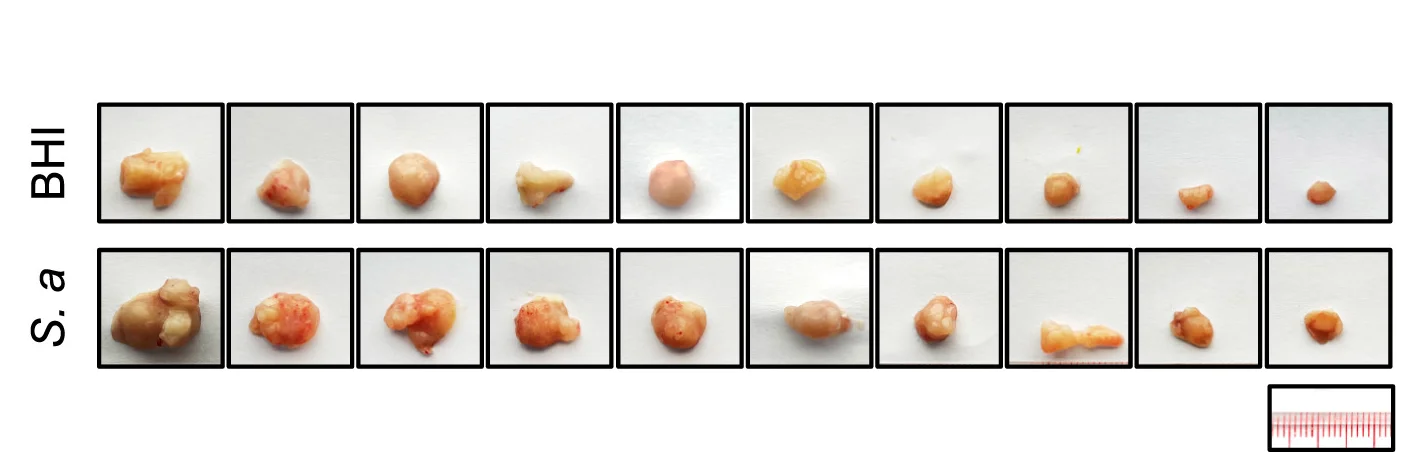 Open access visualization of Photo, Tumor Images, BHI, S. Anginosus