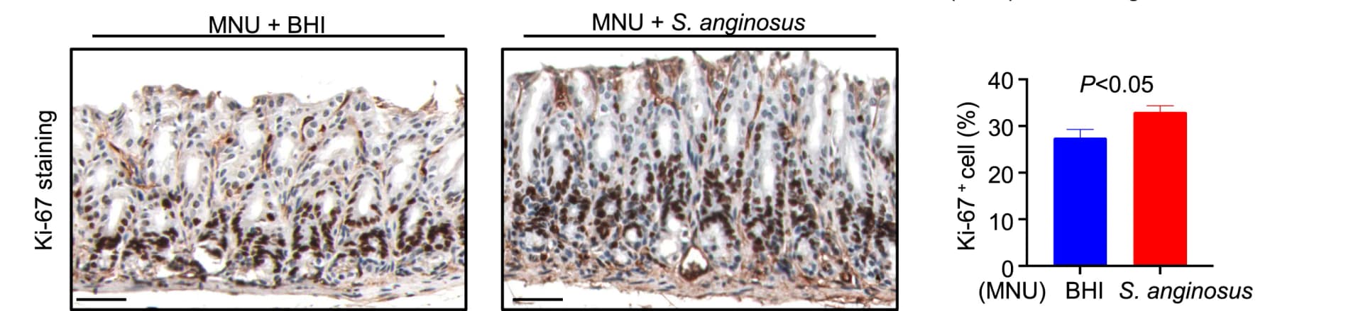 Open access visualization of Bar Plot, Error Bars, Microscopy, Photo, Ki-67 Staining