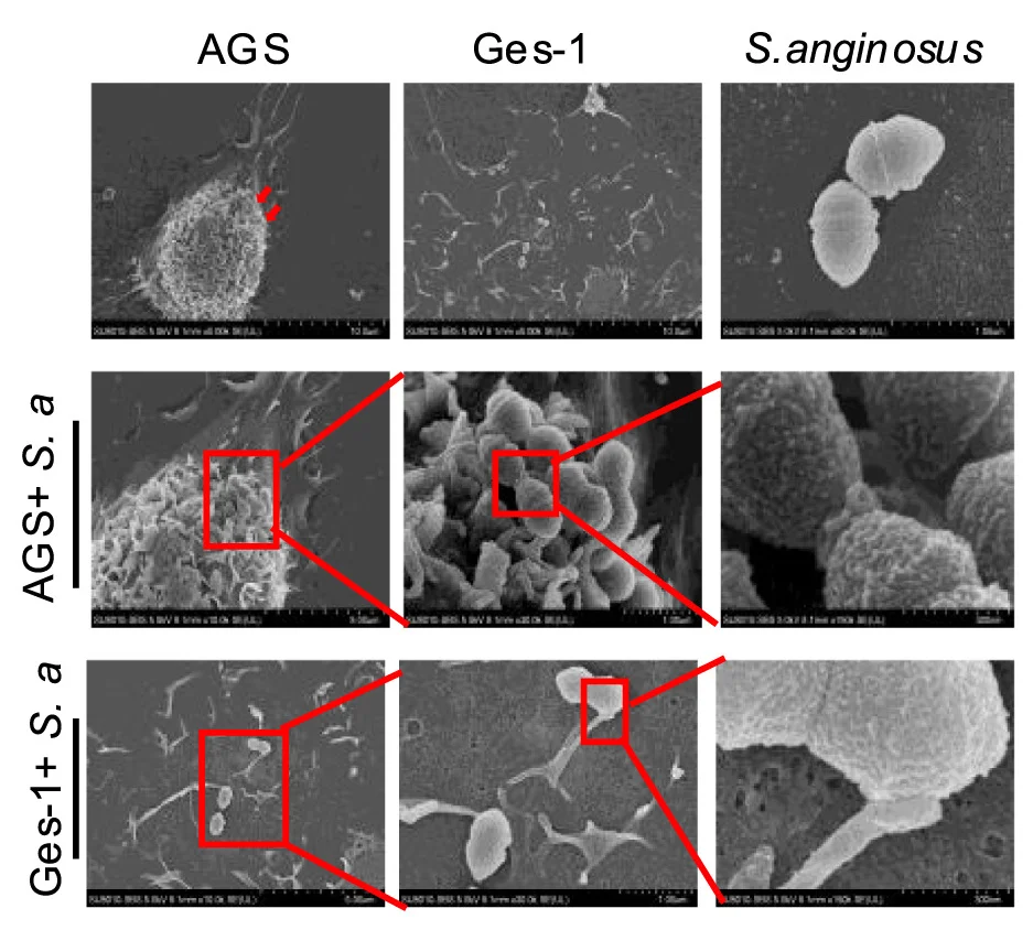 Open access visualization of Microscopy, Scanning Electron Microscopy, SEM Images, AGS Cells, Ges-1 Cells