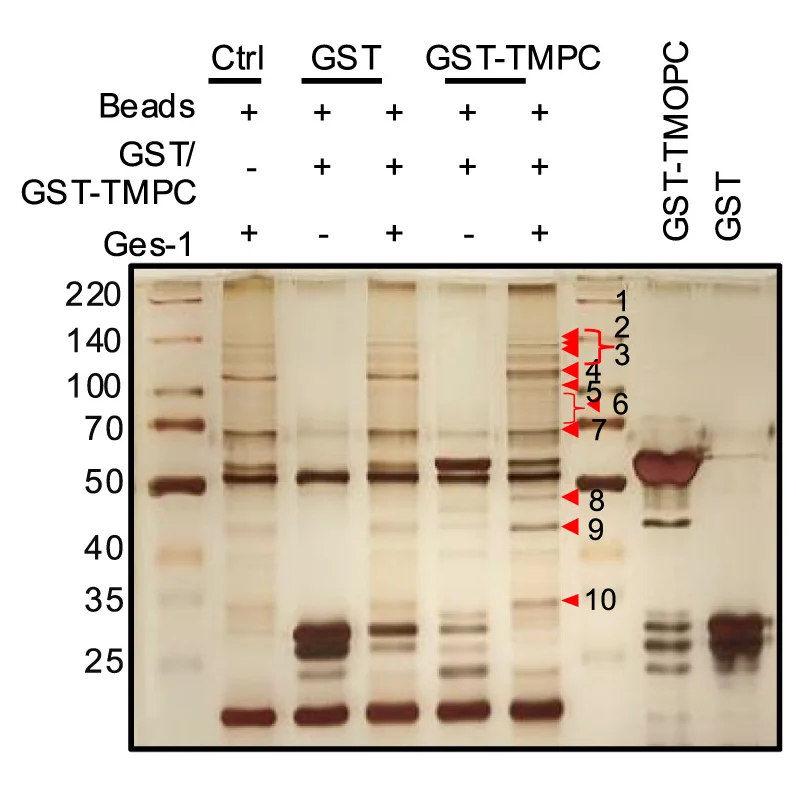 Open access visualization of Gel, Ges-1 Membrane Protein, GST Pull-down Assay, GST-TMPC, Mass Spectrometry