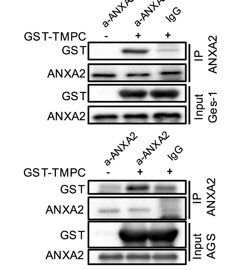 Open access visualization of Gel, Immunoprecipitation, ANXA2, Ges-1 Cells Lysates, AGS Cells Lysates