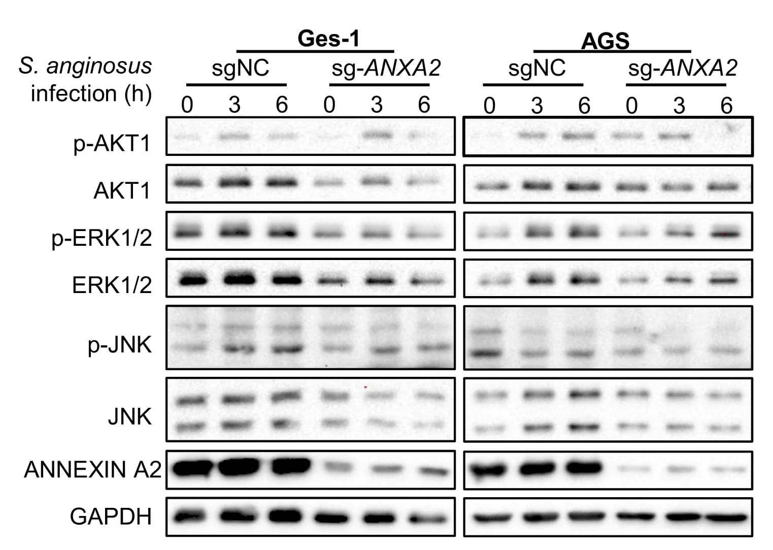Open access visualization of Gel, ANXA2 Knockout, S. Anginosus, MAPK Signaling Pathway