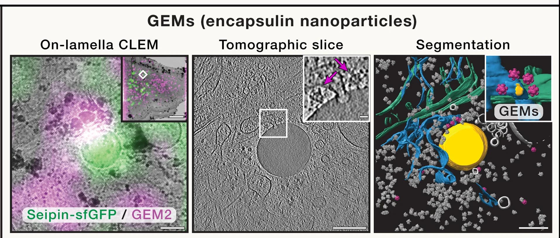 Open access visualization of Microscopy, GEMs, Cryo-FM, Cryo-TEM, Human Cell