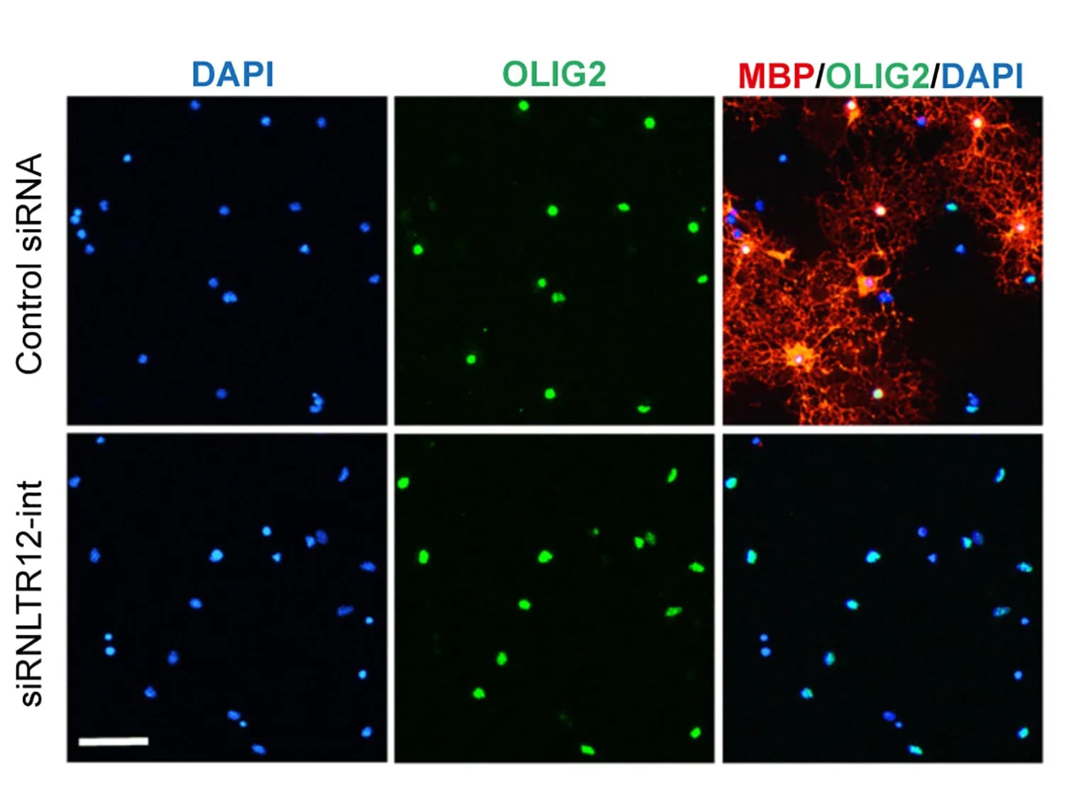 Open access visualization of Microscopy, Immunofluorescence, OLIG2, MBP, OPCs