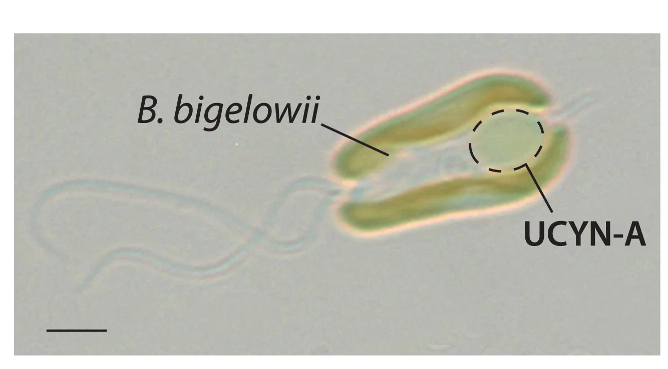 Open access visualization of Microscopy, Light Microscopy, Haptophyte, B. Bigelowii, UCYN-A