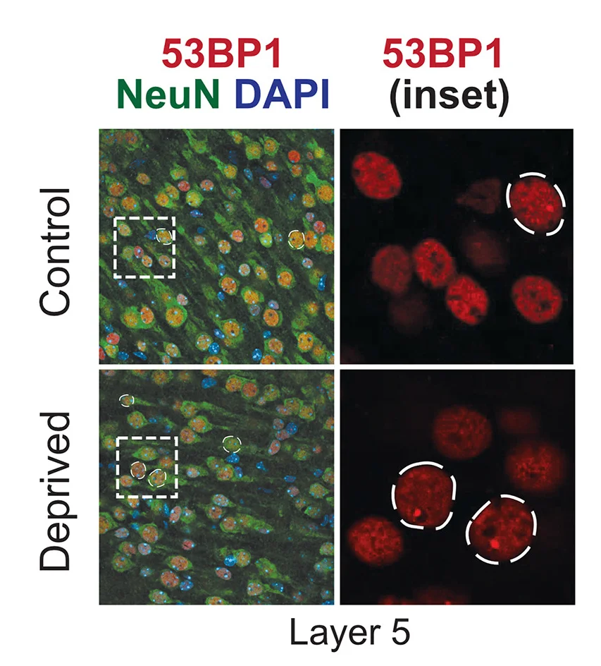 Open access visualization of Microscopy, 53BP1 Foci, Barrel Cortex, Neurons