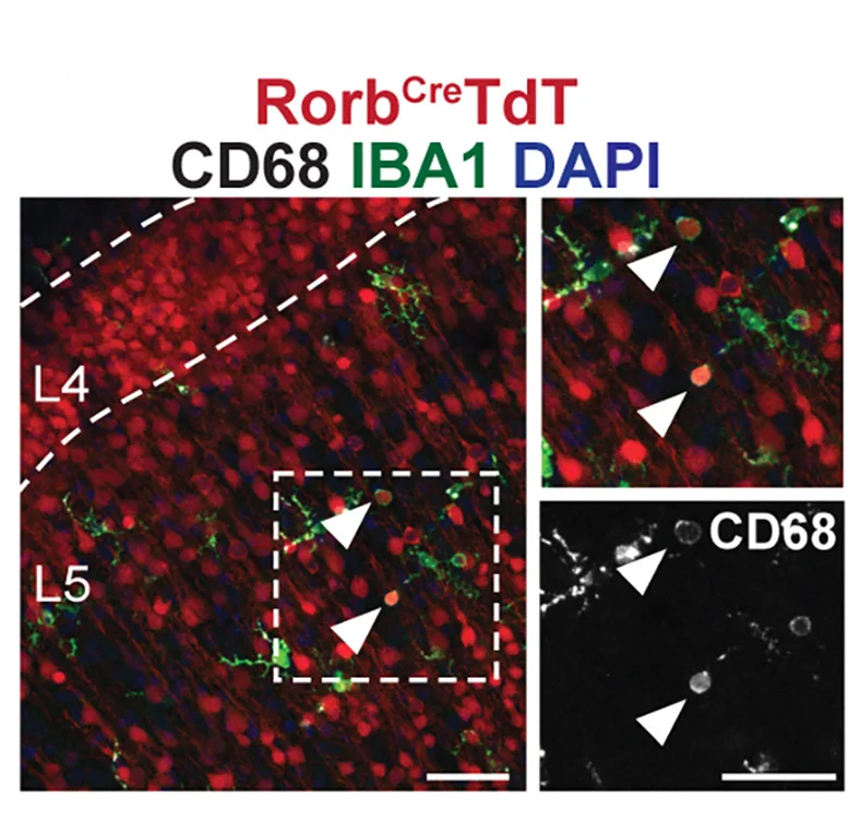Open access visualization of Microscopy, Microglia, IBA1, Neuron, RorbcreTdT