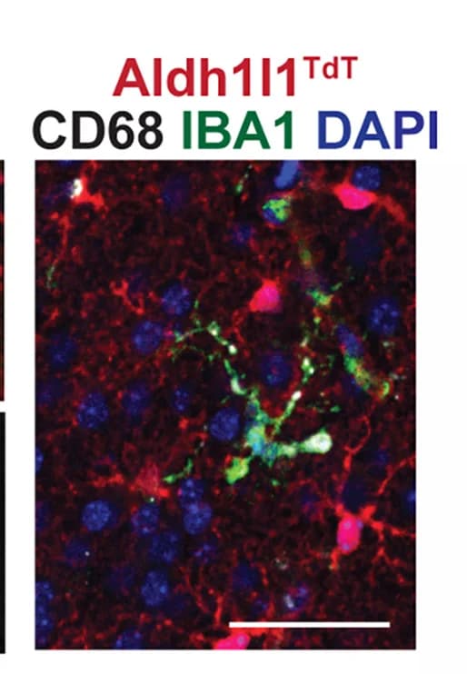 Open access visualization of Microscopy, Microglia, IBA1, Astrocyte, Aldh11L1TdT