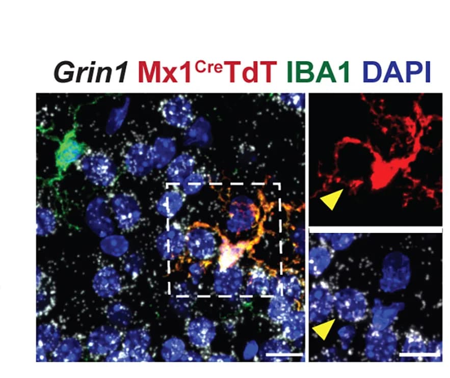 Open access visualization of Microscopy, Microglia, TdTomato, Mx1CRE:Rosa26LSL-TdT, IBA1