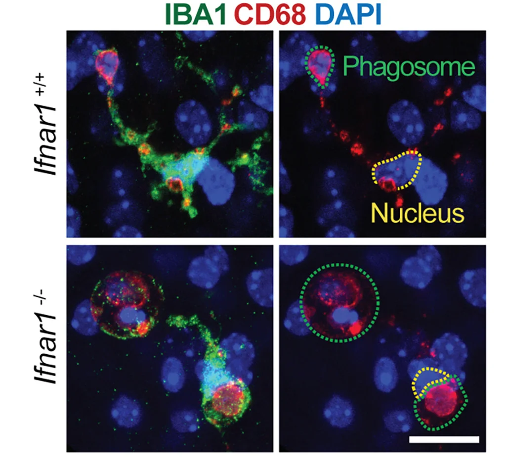 Open access visualization of Microscopy, Microglia, Barrel Cortex, Ifnar1+/+ Mice, Ifnar1-/- Mice