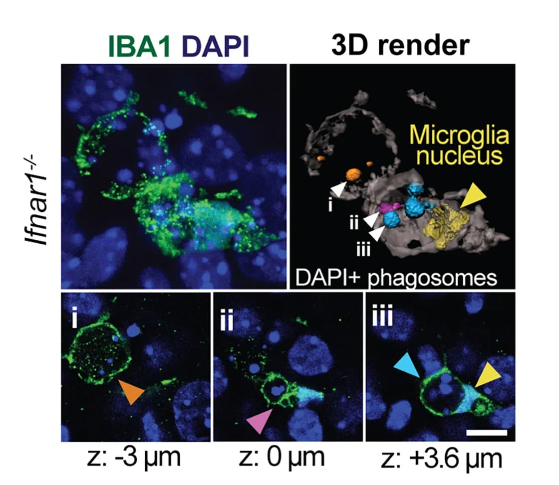 Open access visualization of Microscopy, 3D Plot, Microglia, Phagosomes, Barrel Cortex