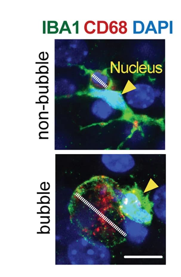 Open access visualization of Microscopy, Non-Bubble Microglia, Compact Phagosome, Bubble Microglia, Enlarged Phagosome