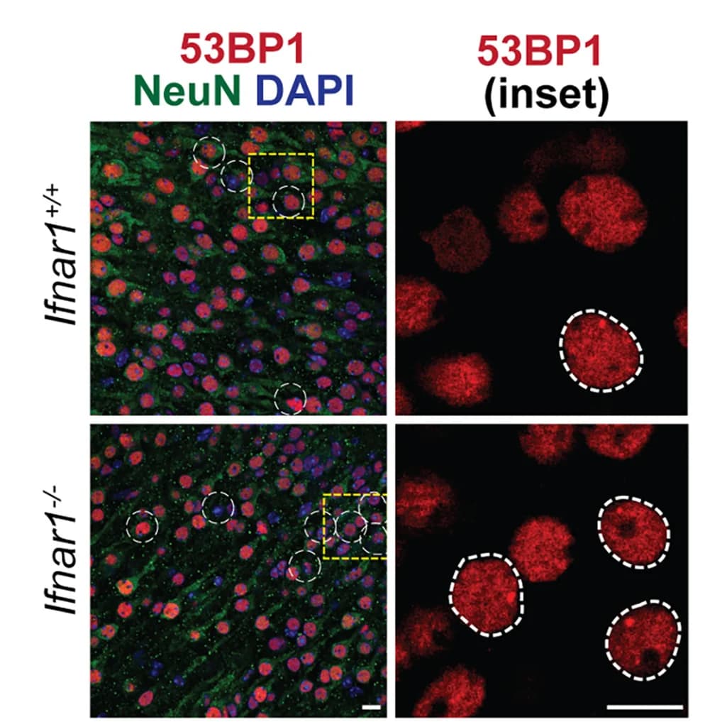 Open access visualization of Microscopy, 53BP1 Foci, Neurons, Barrel Cortex, Ifnar1+/+ Mice