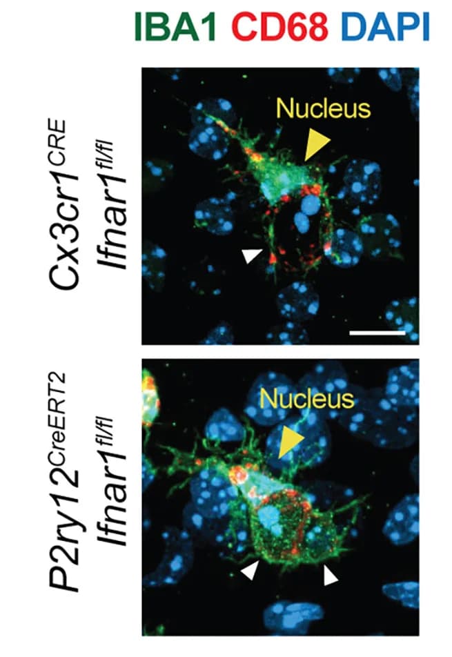 Open access visualization of Microscopy, Microglia, Barrel Cortex, CD68, DAPI