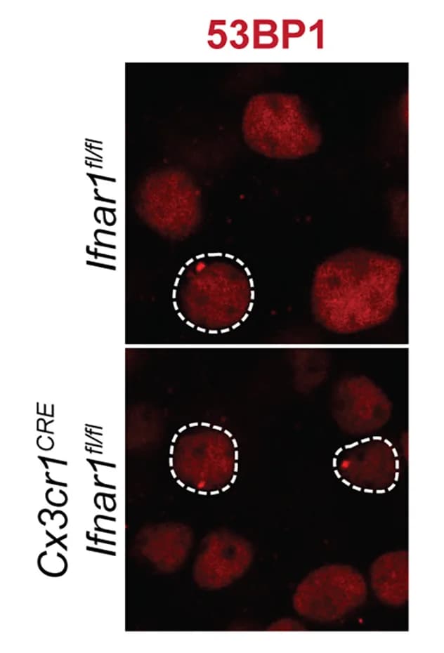 Open access visualization of Microscopy, 53BP1 Foci, Neurons, Barrel Cortex, Nuclei
