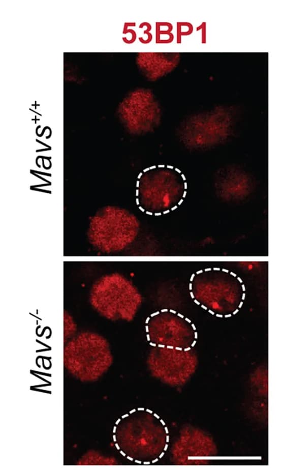 Open access visualization of Microscopy, 53BP1 Foci, Neurons, Barrel Cortex, Nuclei
