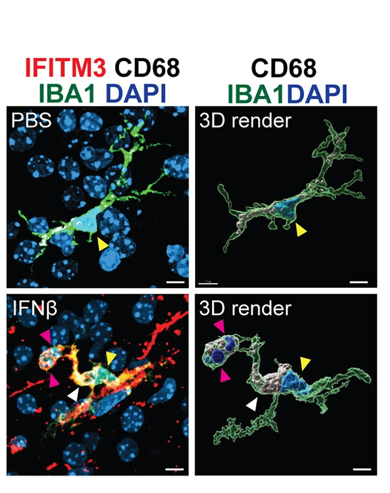 Open access visualization of Microscopy, 3D Plot, Microglia, PBS, IFN-β
