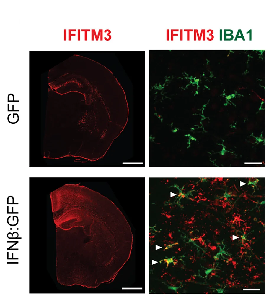 Open access visualization of Microscopy, IFITM3 Induction, Viral Infection, IFITM3+ Microglia