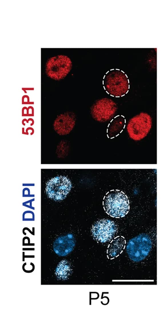 Open access visualization of Microscopy, 53BP1+ Foci, CTIP2, Barrel Cortex, Layer 5