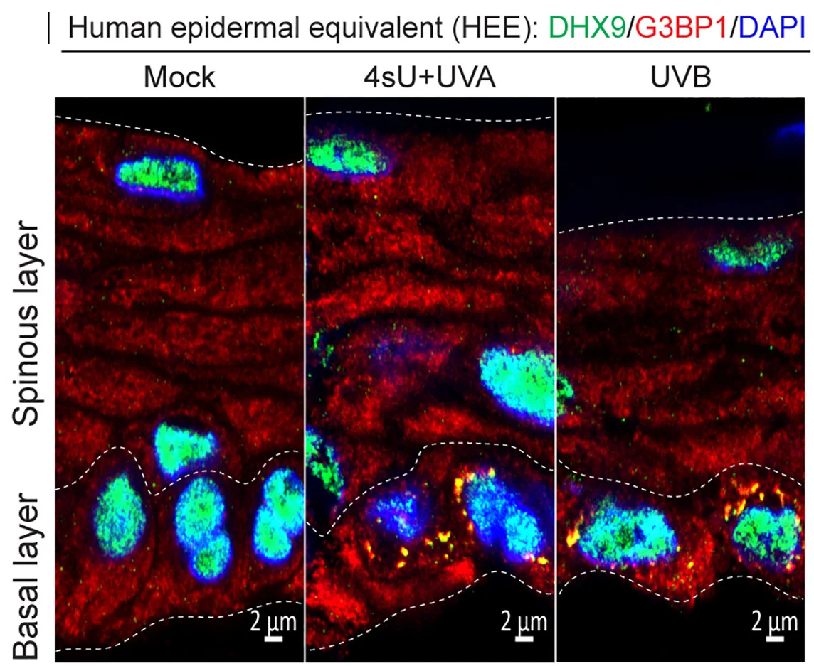 Open access visualization of Microscopy, Confocal Images, DHX9, G3BP1, Cryosections