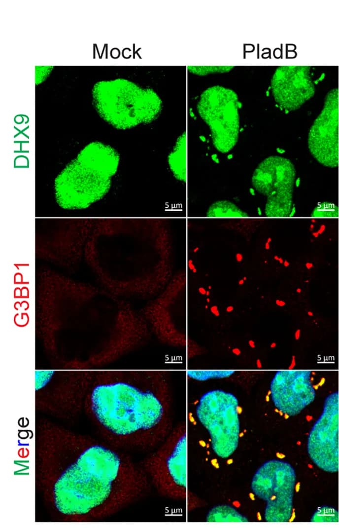 Open access visualization of Microscopy, Confocal Images, DHX9, Stress Granules, HeLa Cells