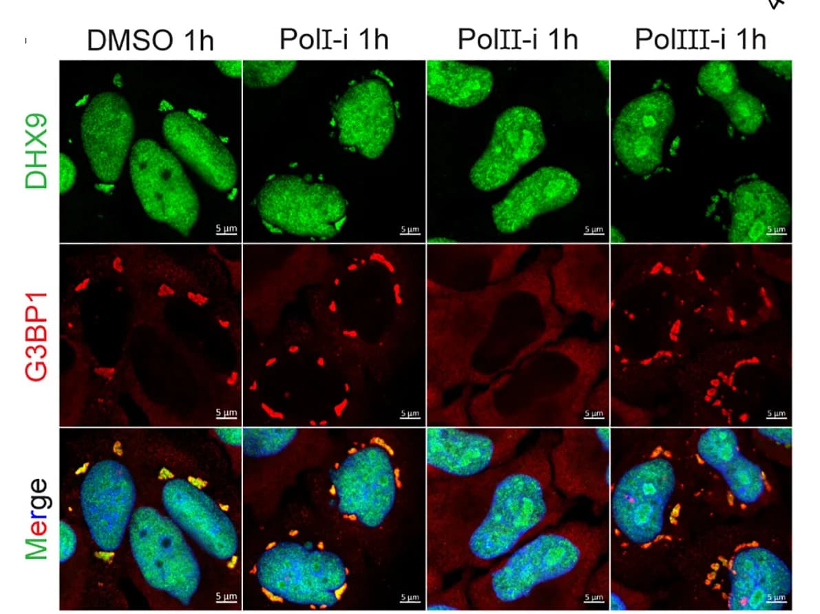 Open access visualization of Microscopy, DHX9, G3BP1, HeLa Cells, RNA Polymerase Inhibitors