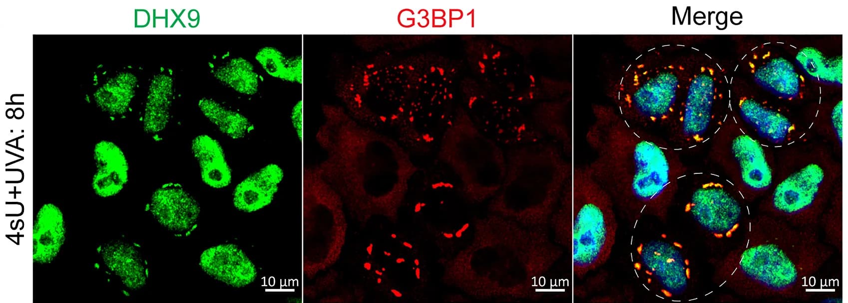Open access visualization of Microscopy, Confocal Images, DHX9, G3BP1, HeLa Cells
