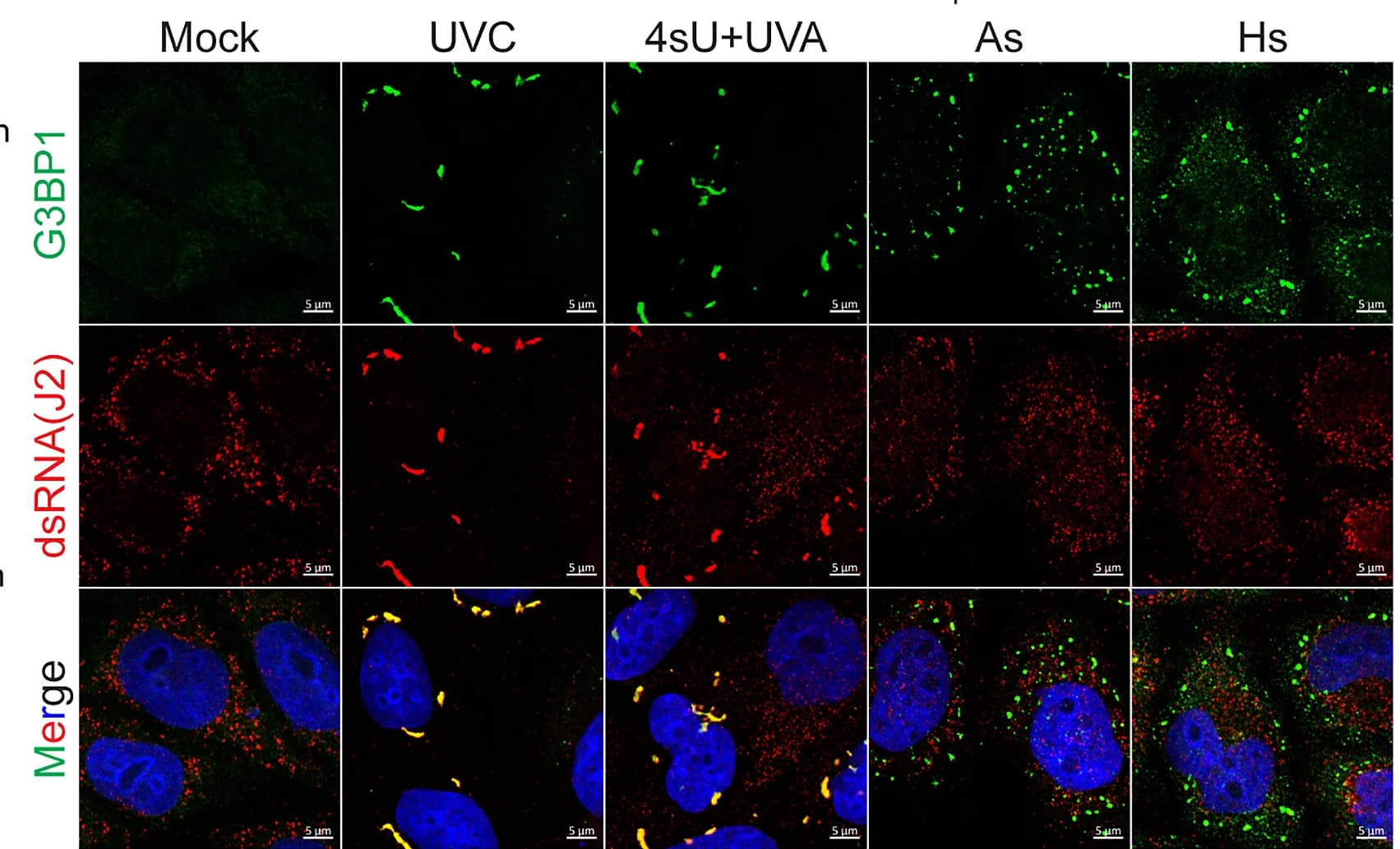Open access visualization of Microscopy, Confocal Images, G3BP1, dsRNA(J2), HeLa Cells