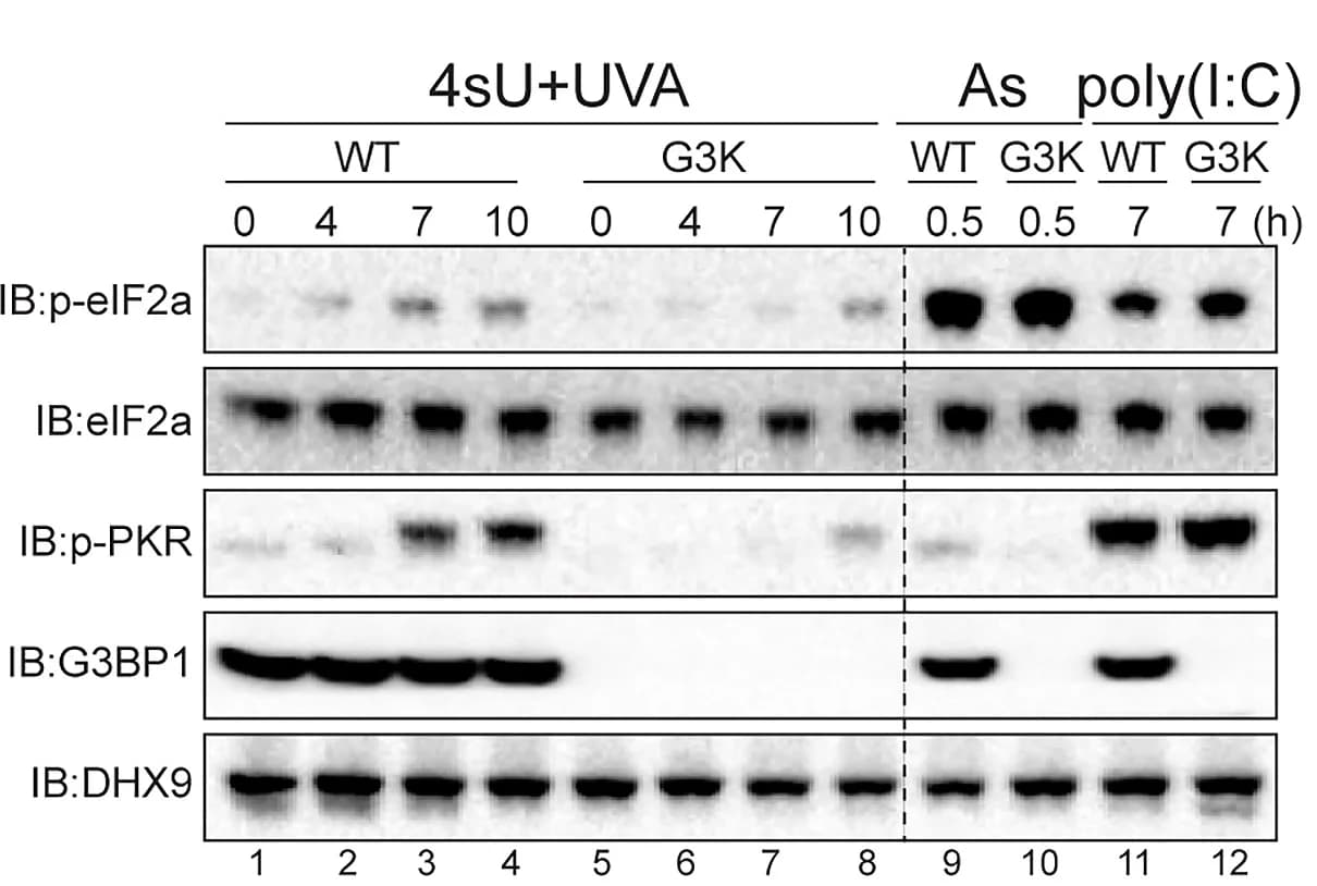 Open access visualization of Gel, Immunoblot, eIF2a, PKR Phosphorylation, HeLa Cells