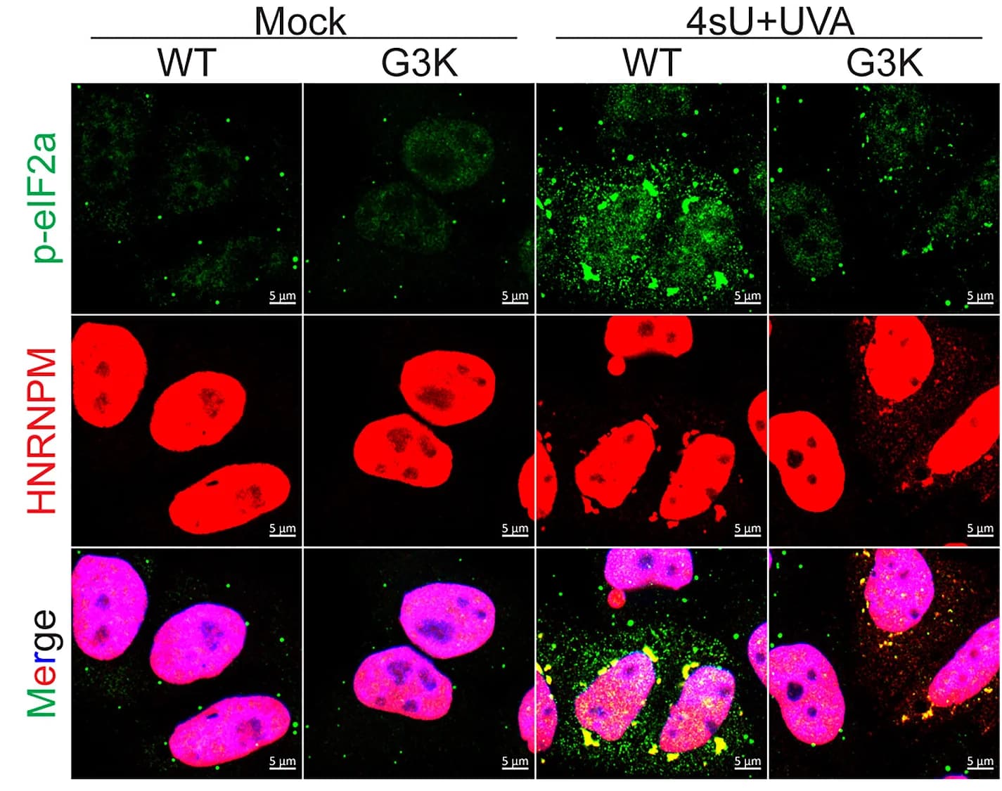 Open access visualization of Microscopy, HNRNPM, p-eIF2a Staining, HeLa Cells, 4sU