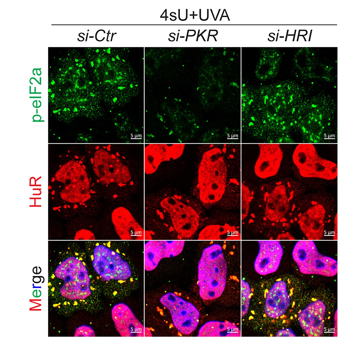 Open access visualization of Microscopy, Proteins, Puromycin Staining, HeLa Cells, siRNAs