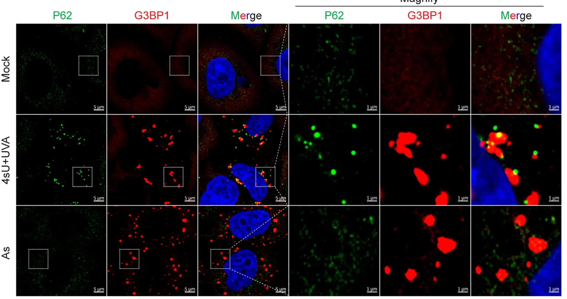 Open access visualization of Microscopy, Images, G3BP1, p62, HeLa Cells