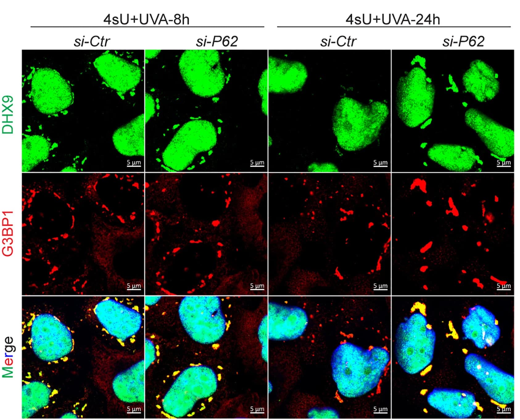 Open access visualization of Microscopy, Images, G3BP1, DHX9, p62-depleted HeLa Cells