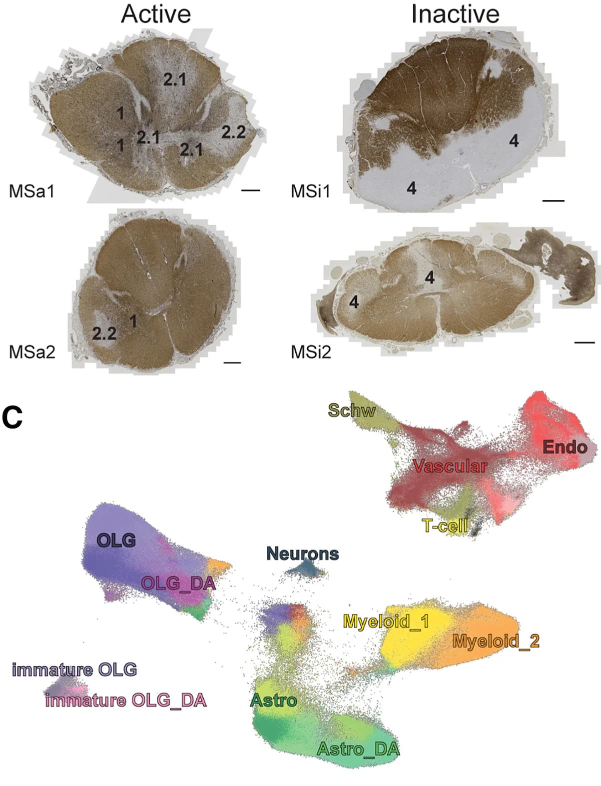 Open access visualization of Microscopy, Scatter Plot, Cervical Cross Sections, MS Patients, Active Lesions
