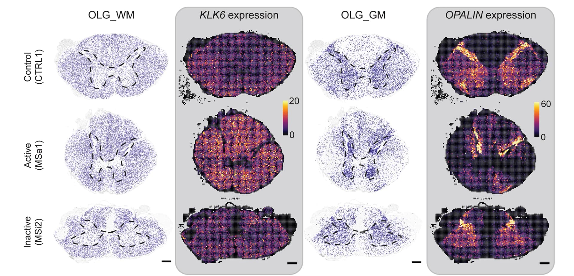 Open access visualization of Heatmap, Microscopy, Spatial Maps, Oligodendrocytes, OLG_WM