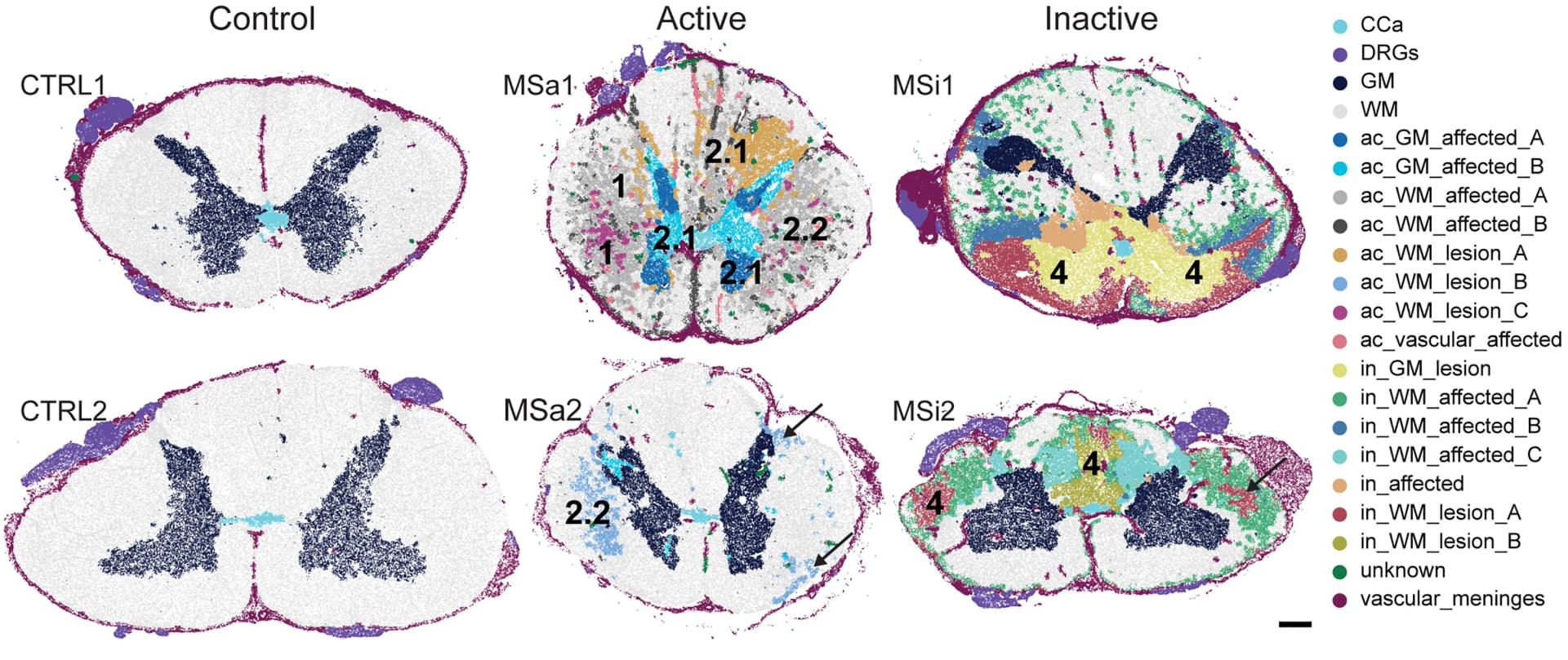 Open access visualization of Microscopy, Spatial Maps, Cells, Compartment, Lesions